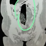 Şehirler Arası Yolculukta Uyuşturucu Şoku!