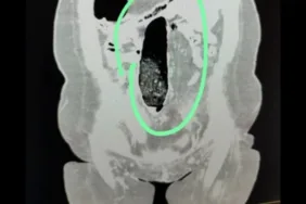 Şehirler Arası Yolculukta Uyuşturucu Şoku!